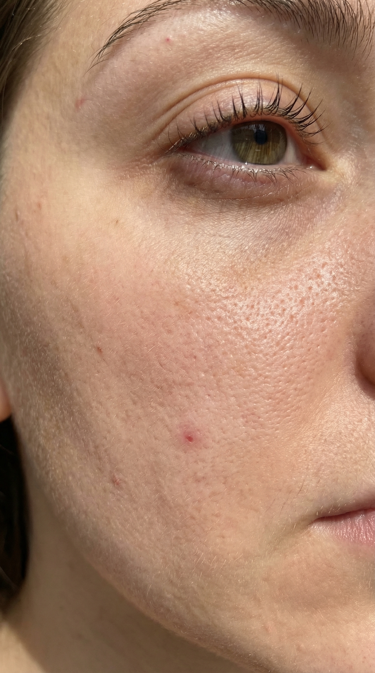 რეტუშამდე